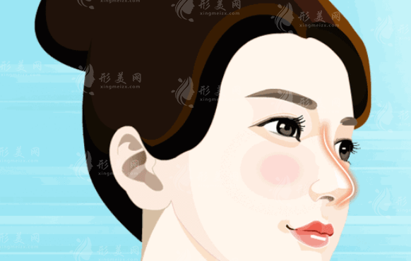 隆鼻修復(fù)的假體取出方法都有哪些呢？