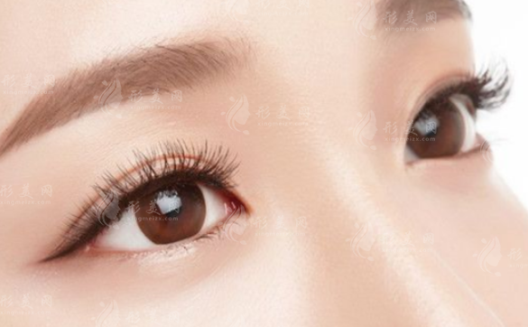 雙眼皮割寬了能修復(fù)嗎？修復(fù)方法是什么？