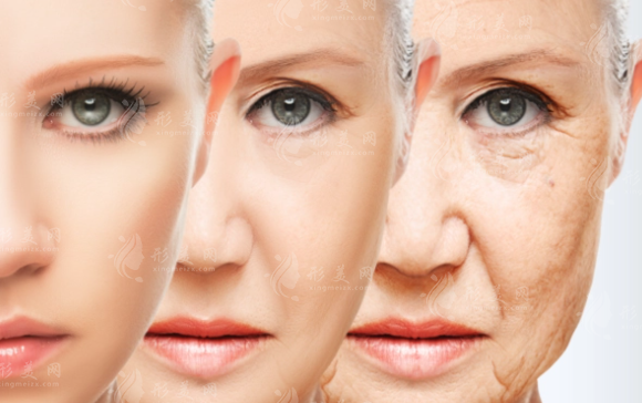 想要告別皺紋？電波拉皮全面解讀！