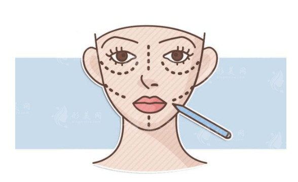 磨腮削骨手術(shù)風(fēng)險大揭秘：你知道多少？