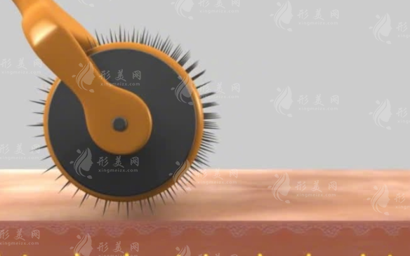 微針滾輪生發(fā)使用頻率是多久？微針滾輪生發(fā)會傷害毛囊嗎