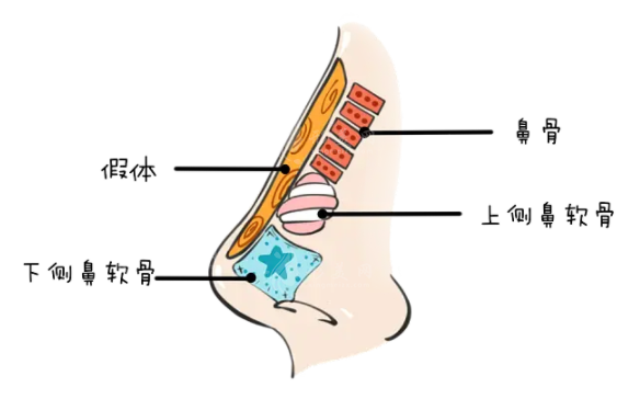 酒糟鼻切割術(shù)與劃痕術(shù)的區(qū)別有哪些？
