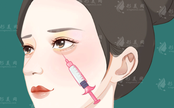 玻尿酸打臥蠶有風(fēng)險嗎？主要包括哪些方面？