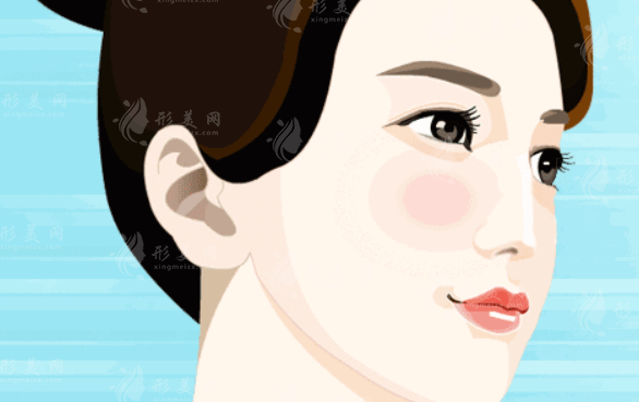 膨體隆鼻好取出來(lái)嗎？填充物是什么材料？