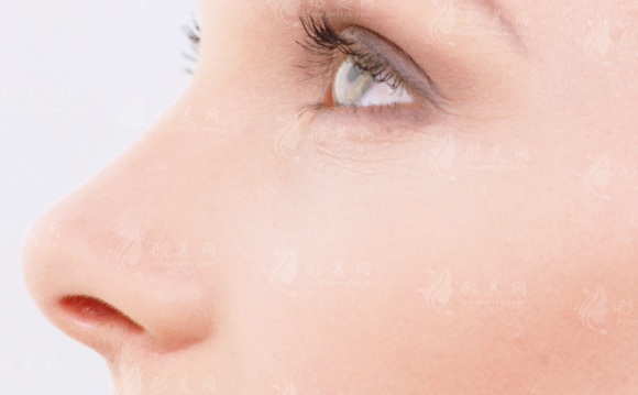 脂肪填充鼻子會不會變寬？是為什么呢？