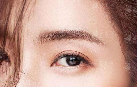 脂肪填充眉弓顯得眼睛凹陷怎么處理？