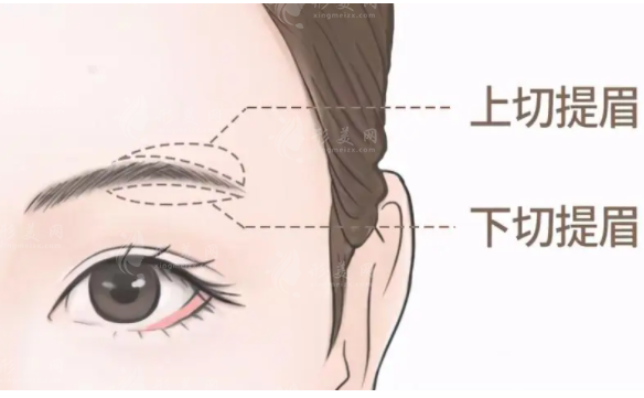 切眉和提眉有啥區(qū)別？本文為你解答