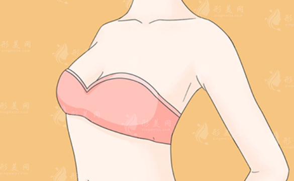 乳房再造手術(shù)的安全性和潛在風(fēng)險(xiǎn)有哪些？