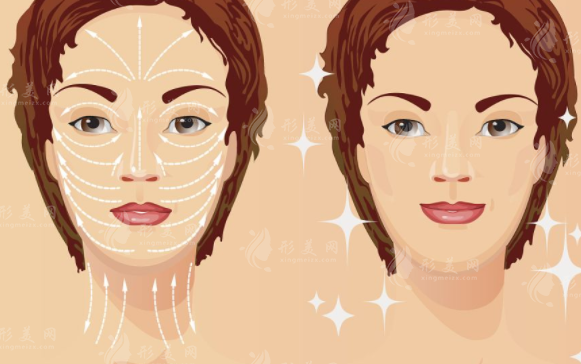 40歲做線雕還是熱瑪吉效果好？該如何選擇呢？