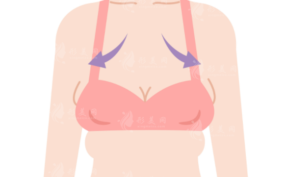 西京醫(yī)院做縮胸手術(shù)好嗎？醫(yī)生推薦、案例分享以及價(jià)格表在線參考