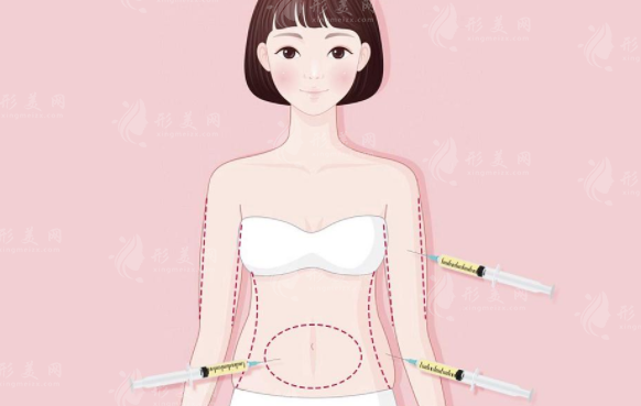 西京醫(yī)院全身吸脂多少錢？專家介紹+案例分享+2023吸脂價(jià)目表