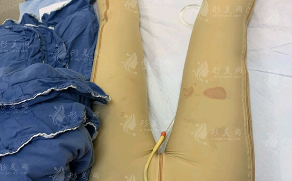 北京八大處大腿吸脂多少錢？好評(píng)醫(yī)生|案例介紹|整形價(jià)格一覽~