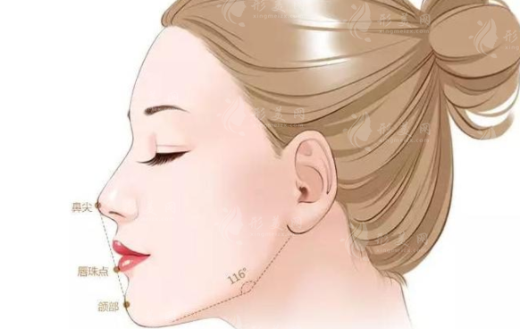 下頜緣提升有哪些方法呢？效果如何？安全性高嗎？