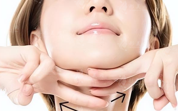 下巴膨體假體取出可以直接放新的嗎？大概多久再次手術(shù)？