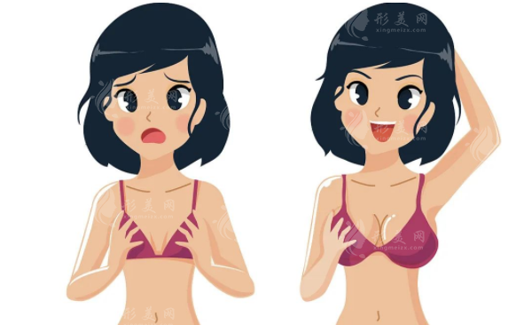 北京八大處穆大力豐胸怎么樣？多少錢？豐胸案例+收費(fèi)價(jià)格表