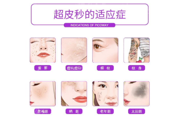 上海九院祛斑多少錢？新版價格表|超全項(xiàng)目醫(yī)生推薦