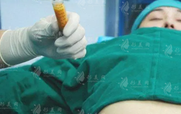 超聲波吸脂的原理以及優(yōu)勢(shì)、劣勢(shì)詳細(xì)解答