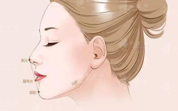 墊下巴手術(shù)風(fēng)險(xiǎn)大嗎？需要全麻嗎？