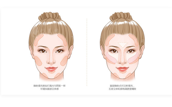 上海九院脂肪抽吸和填充價(jià)格表 上海九院脂肪抽吸和填充價(jià)格表