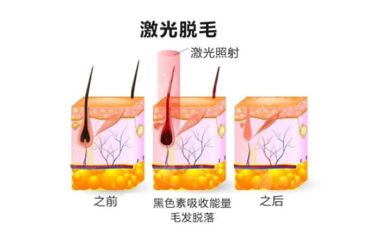 上海九院激光脫毛治療價(jià)格表 上海九院激光脫毛治療價(jià)格表