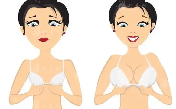 隆胸做隆胸假體好還是自體脂肪好？各有哪些優(yōu)勢呢？