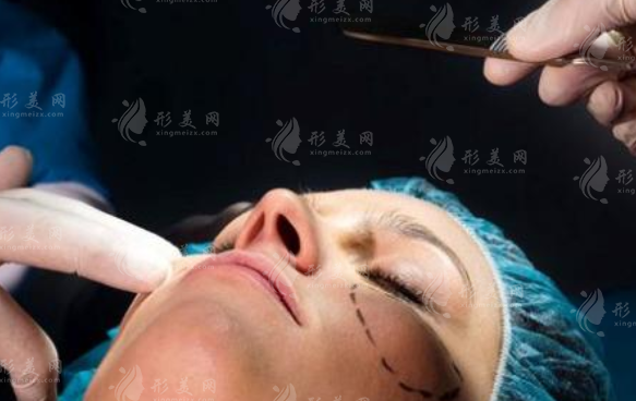 關(guān)于拉皮那些你必須知道的幾個真相！它是否會影響我們的生活？