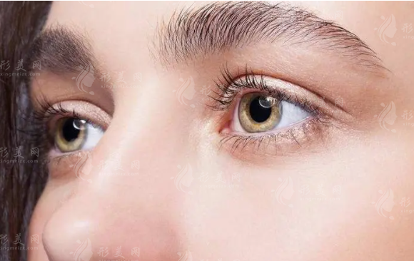 想割雙眼皮，割多少毫米寬比較好？