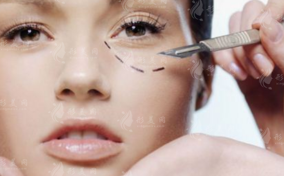 豐臥蠶有哪些方法？術(shù)后有后遺癥嗎？