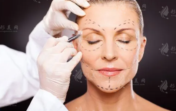 射頻除皺能維持多久？收費價格貴嗎？