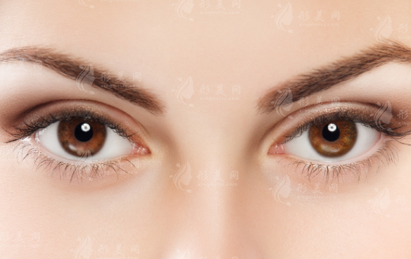 開眼角增生疤痕怎么去除？會自然消失嗎？