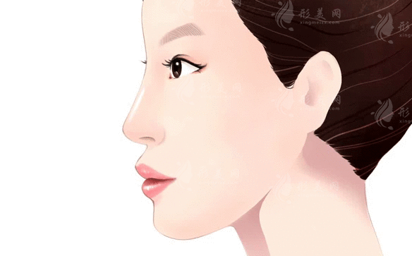 上海伊萊美做鼻子怎么樣？隆鼻專家|隆鼻案例|項(xiàng)目收費(fèi)表一覽！