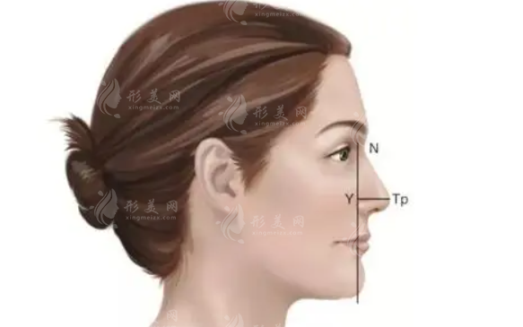 鷹鉤鼻矯正大概需要多少錢？有什么后遺癥嗎？