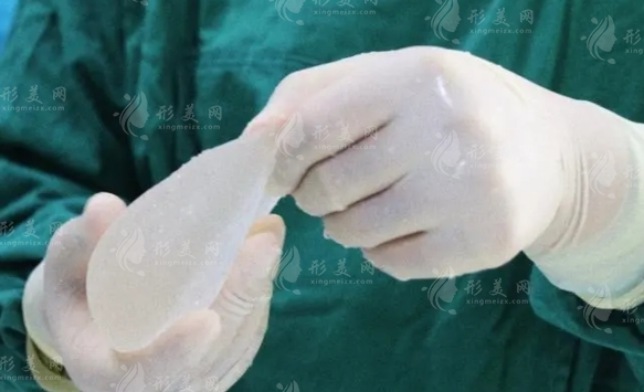 假體隆胸or自體脂肪隆胸，究竟應(yīng)該怎么選？