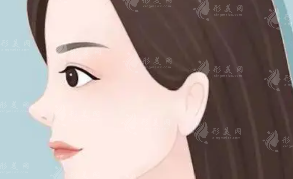 北京畫美醫(yī)院隆鼻整形怎么樣？醫(yī)生專家簡介、案例介紹、收費(fèi)標(biāo)準(zhǔn)