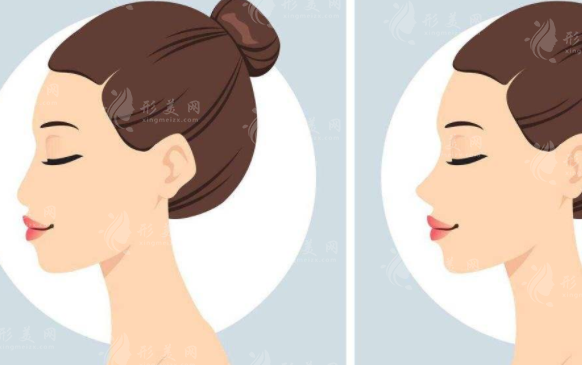 廣州曙光做鼻子多少錢？好評醫(yī)生簡介、案例分享、收費表新鮮出爐！