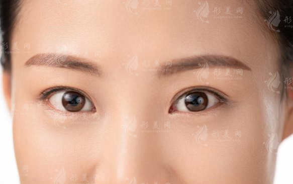 開內(nèi)眼角有增生怎么辦?它會自行消失嗎?