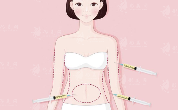 深圳富華抽脂怎么樣？專業(yè)醫(yī)生團隊、抽脂案例、附參考價！