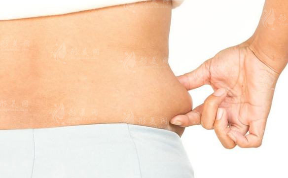 腹部吸脂手術(shù)風(fēng)險以及后遺癥問題，你了解多少了~