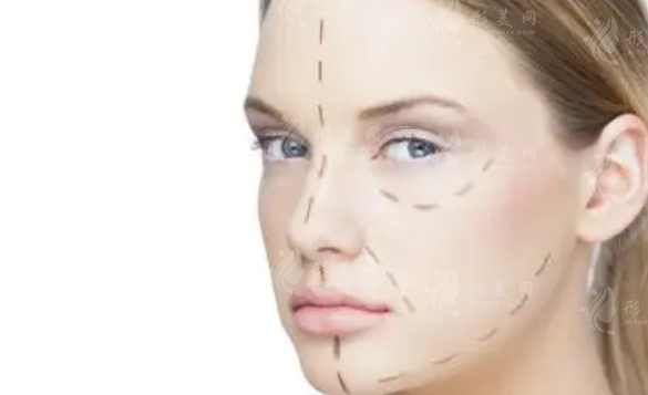 鼻尖整形需要多少錢?術后應該注意什么呢?