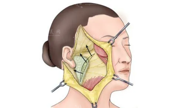 西京醫(yī)院拉皮手術(shù)多少錢(qián)？本院實(shí)力/醫(yī)生介紹/案例分享/價(jià)目表更新