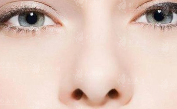 鼻頭縮小手術(shù)有什么后遺癥?該如何避免?