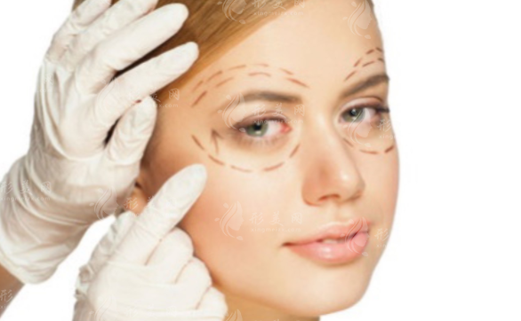 一般雙眼皮埋線多久能修復?手術(shù)有啥優(yōu)勢?