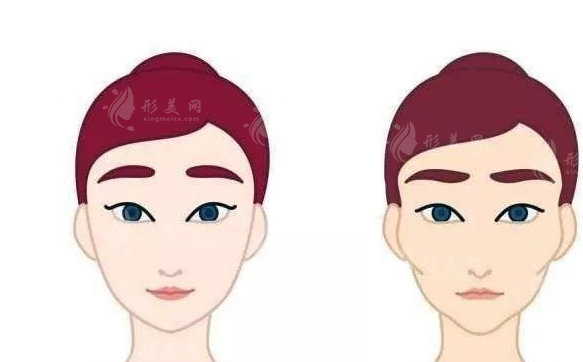 顴骨內(nèi)推老了會(huì)不會(huì)出現(xiàn)副作用？