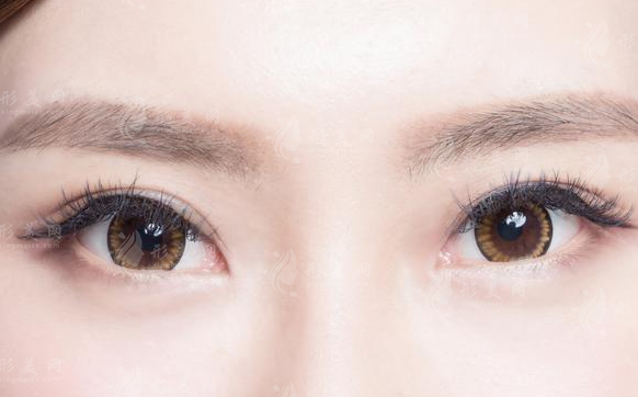 開眼角失敗怎么辦?有沒有比較好的修復(fù)辦法?