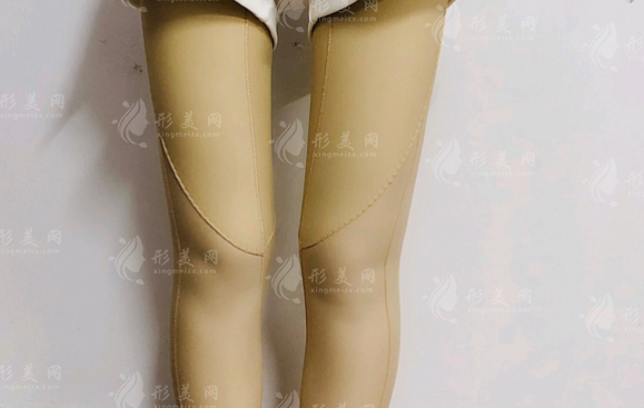 大腿抽脂和水動(dòng)力環(huán)吸哪個(gè)比較好？