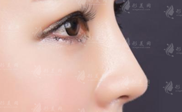 耳軟骨墊鼻尖后遺癥有哪些呢？可以避免嗎？