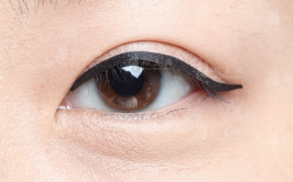 開眼角多長時(shí)間能夠恢復(fù)自然呢?網(wǎng)絡(luò)上都是這樣分析的~