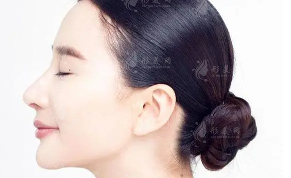 鼻翼太大怎么變小|矯正幾大常規(guī)方法多方面分析~