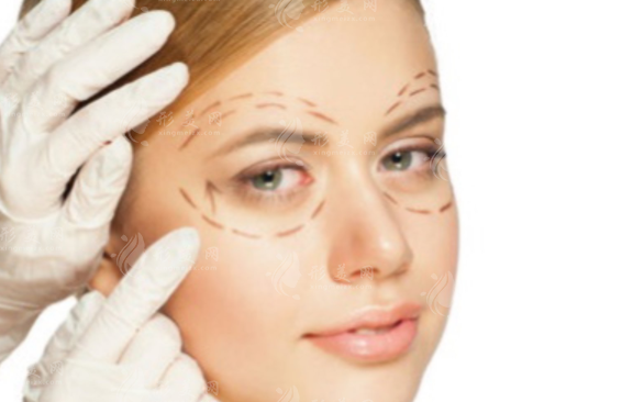 雙眼皮埋線恢復(fù)時(shí)間長嗎？恢復(fù)時(shí)間大概多久?