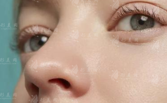 耳軟骨隆鼻尖恢復(fù)時間一般是多久?怎么護理能縮短喃? 耳軟骨隆鼻尖恢復(fù)時間一般是多久?怎么護理能縮短喃?